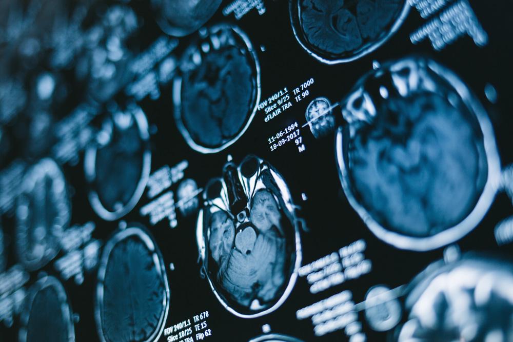 You Are Not Defined By Your MRI Results